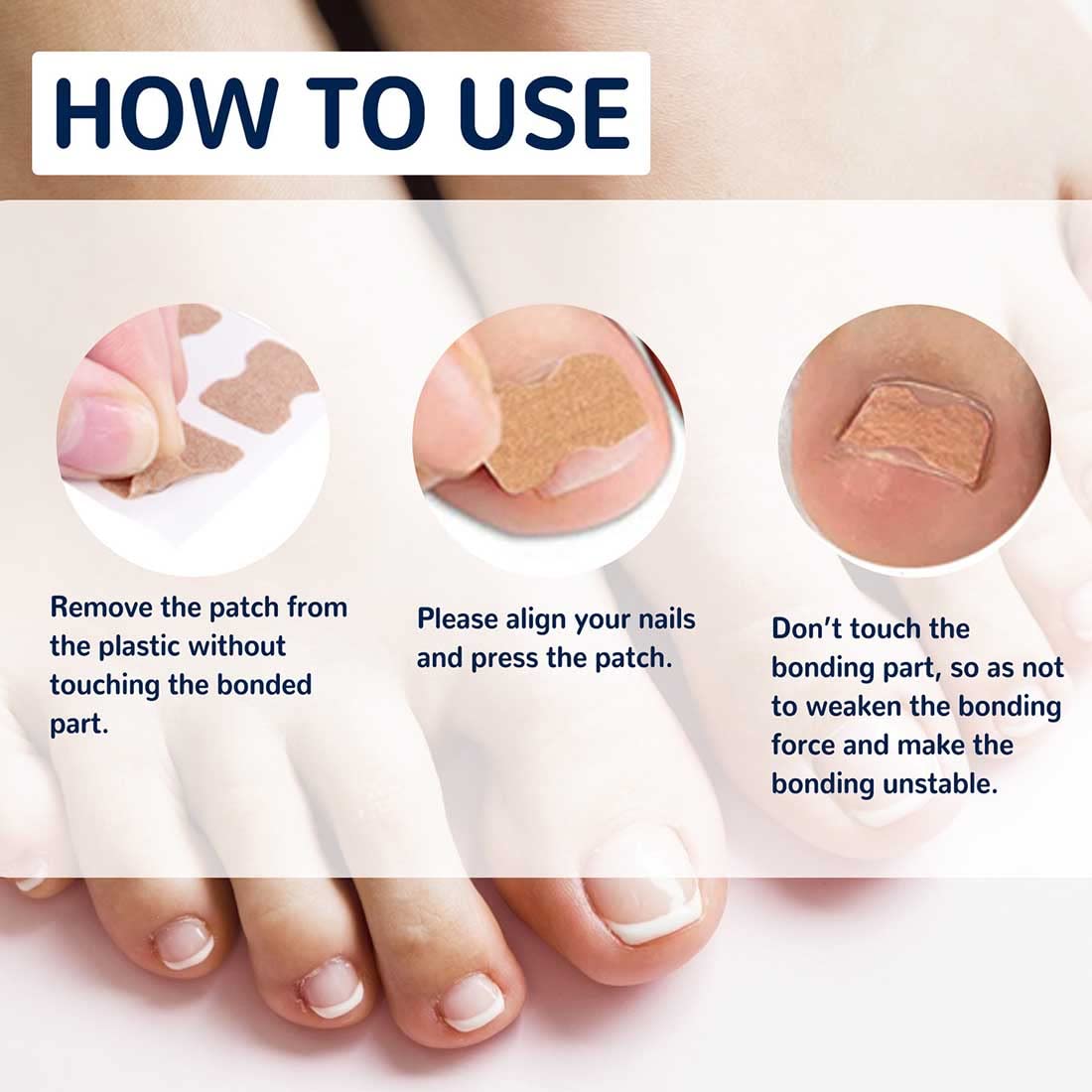 Ingrown Toe Nail Correction Sticker, Toenail Correction Patch, Painless Pedicure Tools, Pack of 50