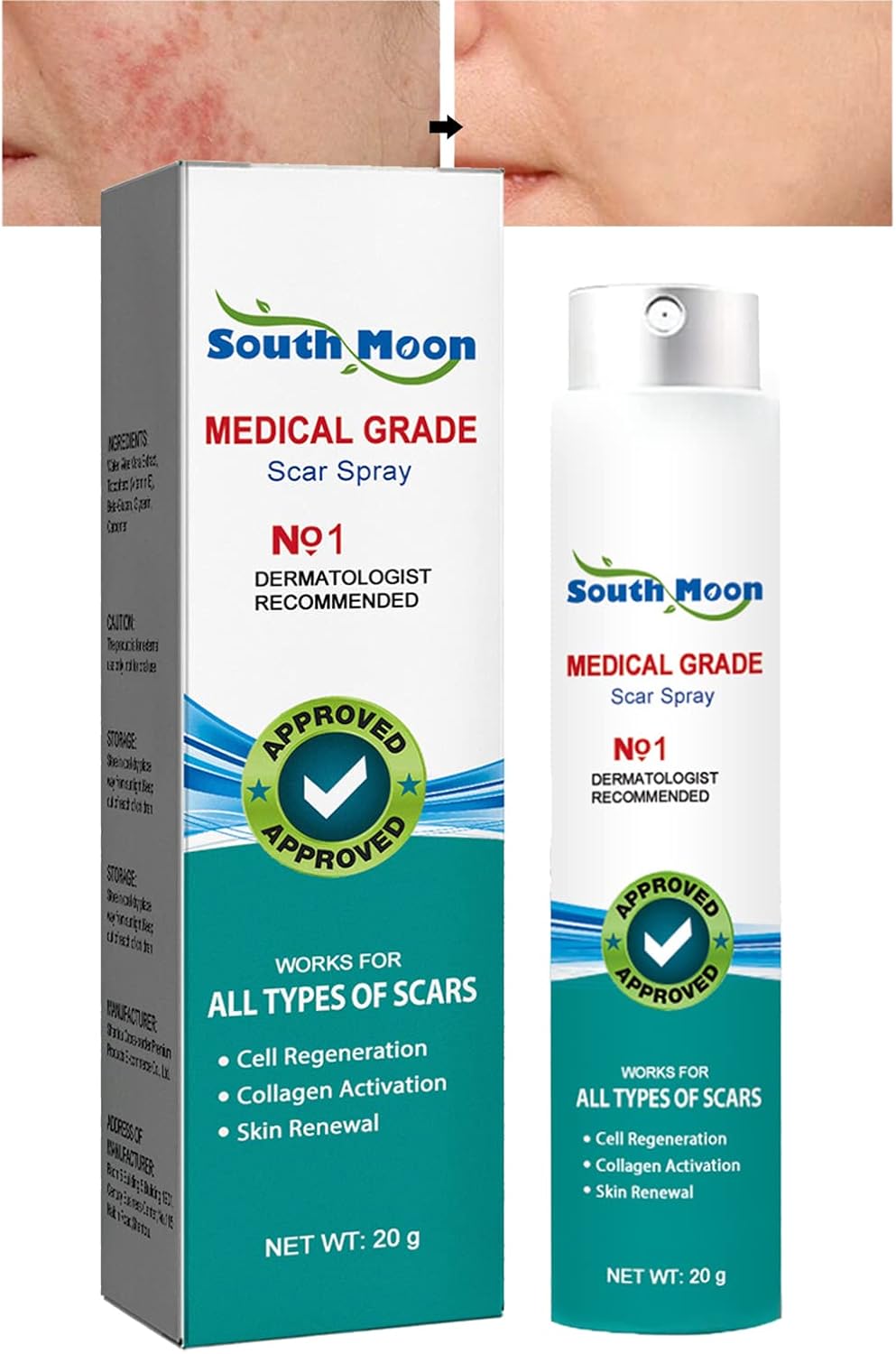 Medical Grade Scar Spray, Scar Remove Medical Grade Scar Spray, Scar Remove Advanced Scar for All Types of Scars (20g)