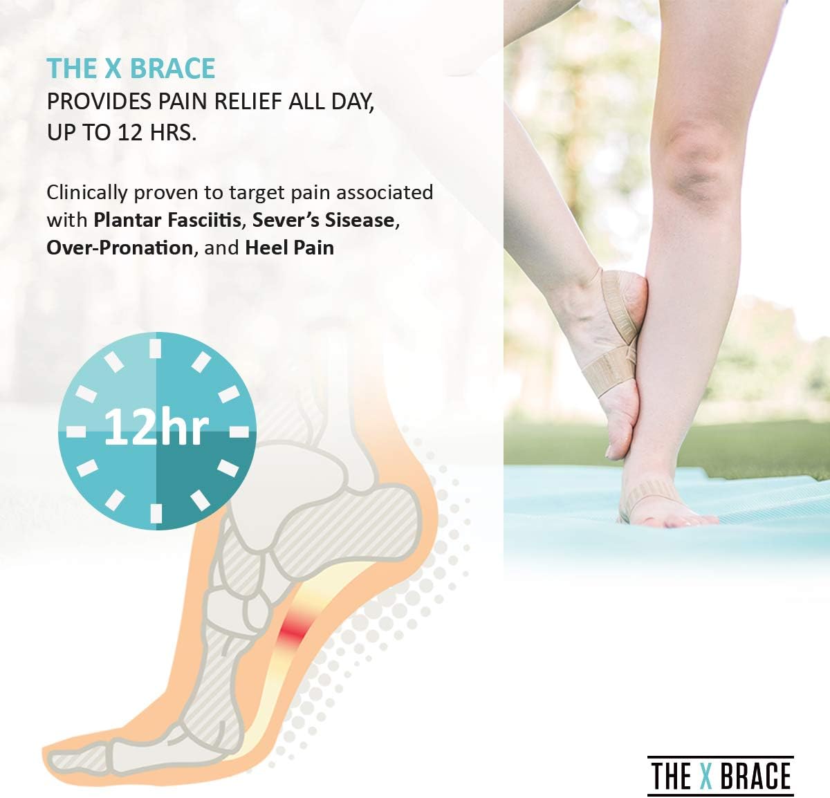 The Original X Brace - Arch Support Brace and Compression for Plantar Fasciitis, Flat Feet, Fallen Arches, Over-Pronation and Heel Pain