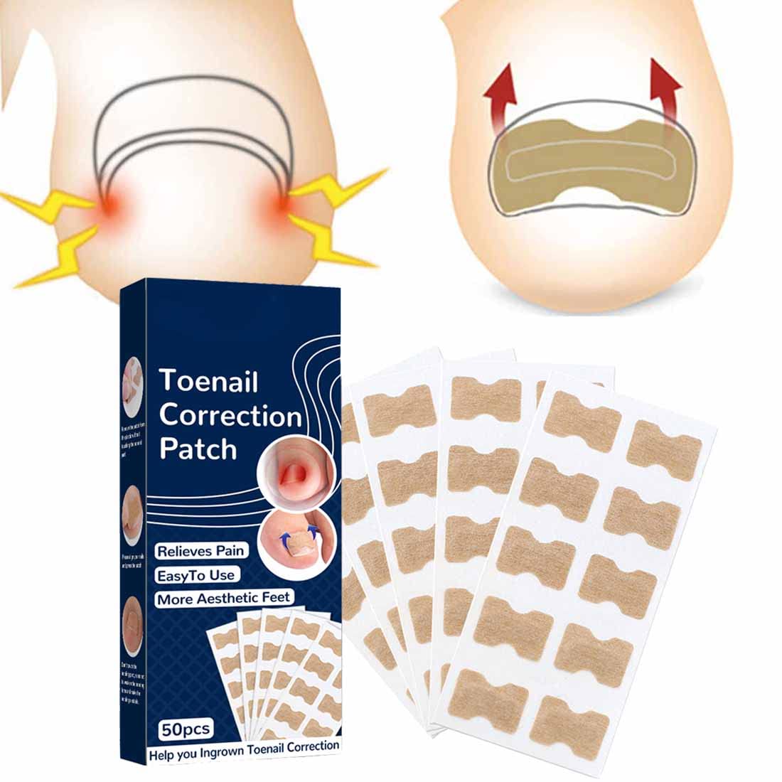 Ingrown Toe Nail Correction Sticker, Toenail Correction Patch, Painless Pedicure Tools, Pack of 50