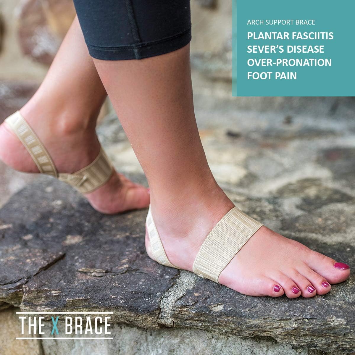 The Original X Brace - Arch Support Brace and Compression for Plantar Fasciitis, Flat Feet, Fallen Arches, Over-Pronation and Heel Pain