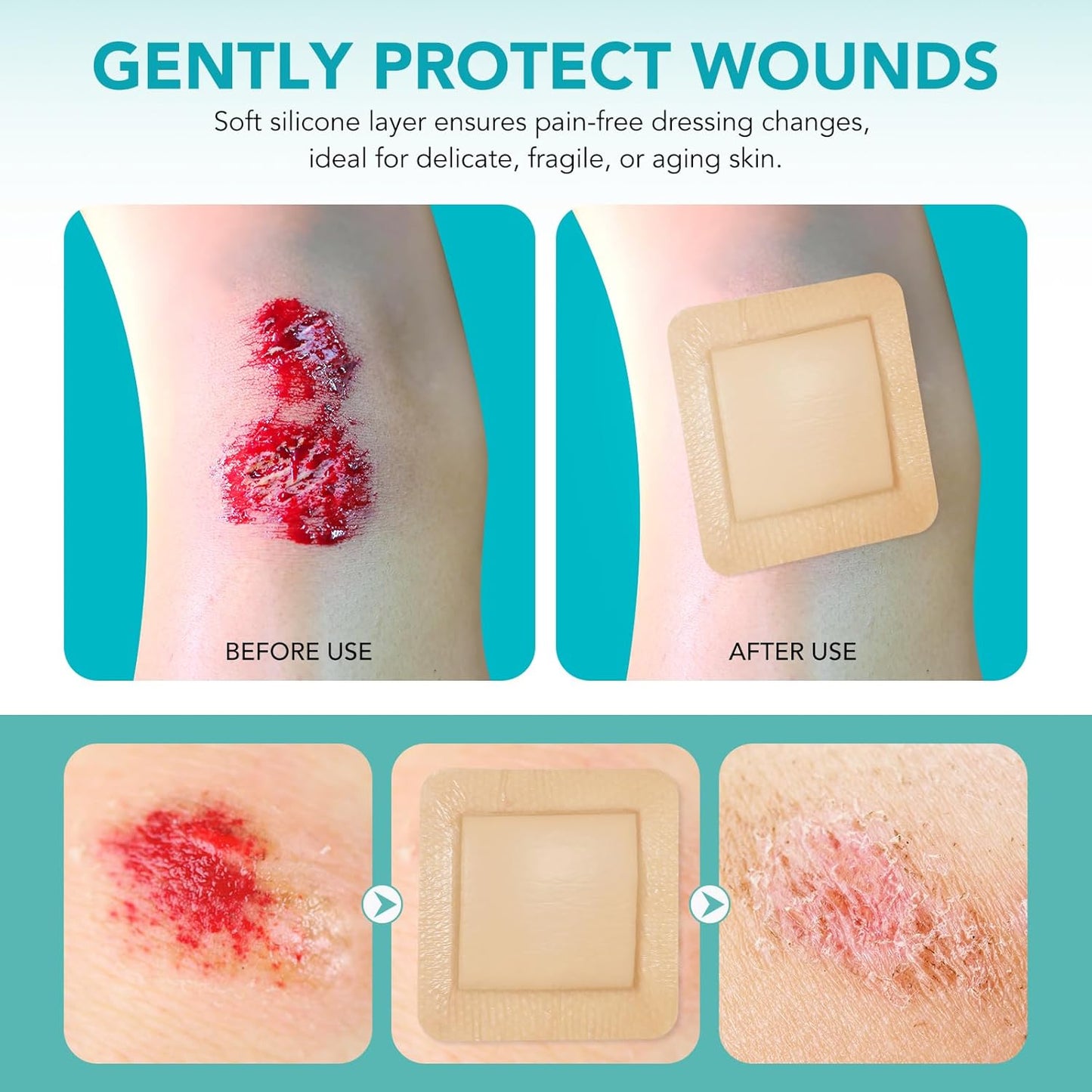 Premium Silicone Foam Dressing 4"x4", Adhesive Waterproof Silicone Bandages with Border, High Absorbent Bed Sore Bandages Wound Care Dressing, 5 Packs