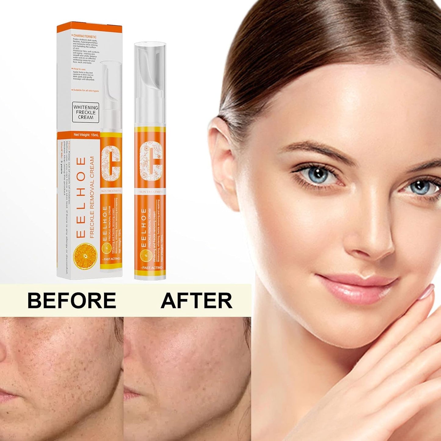 VC Whitening Freckle Cream Pen, Effective Remove Melasma Acne Spots (1PC)