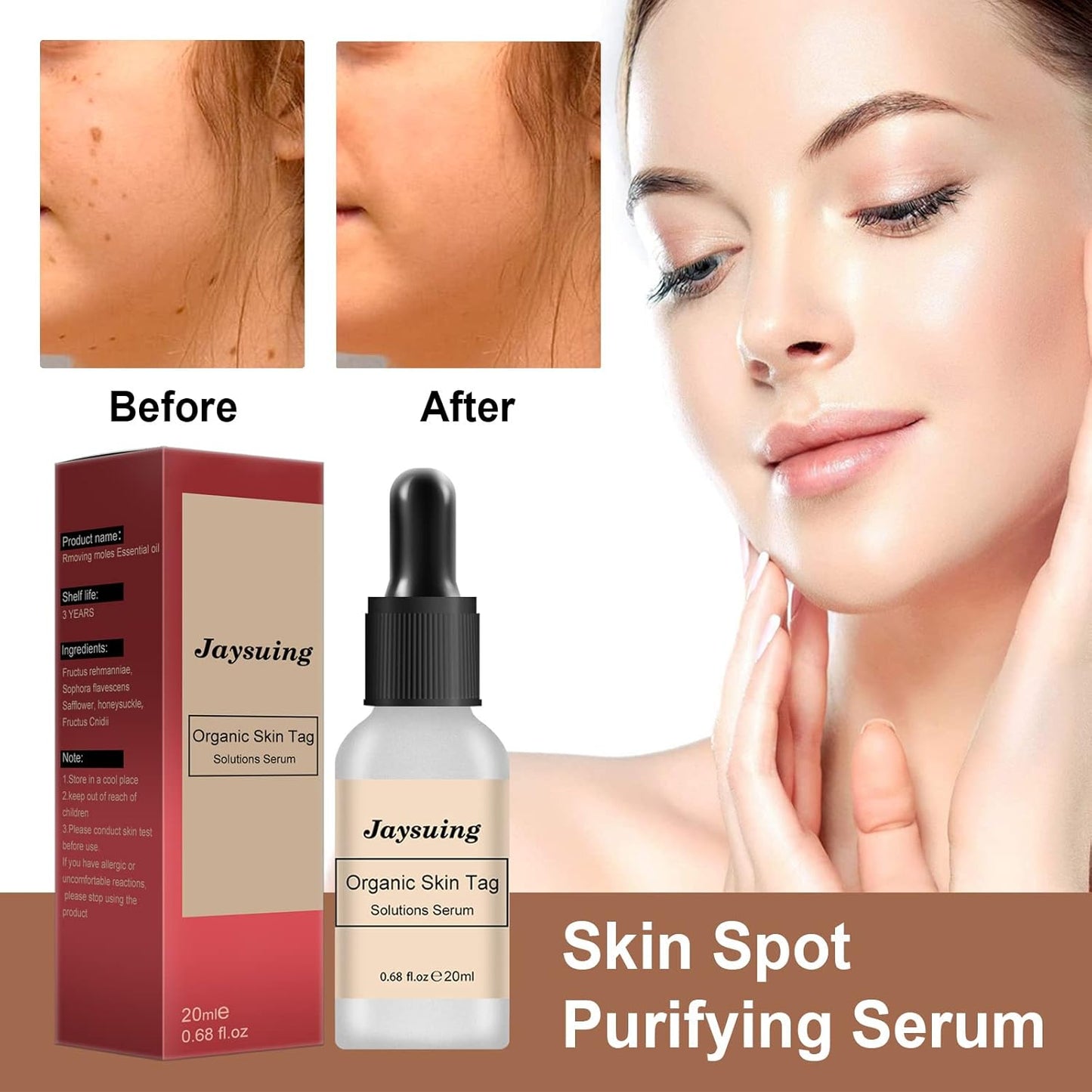 Black Spot Removal Lotion