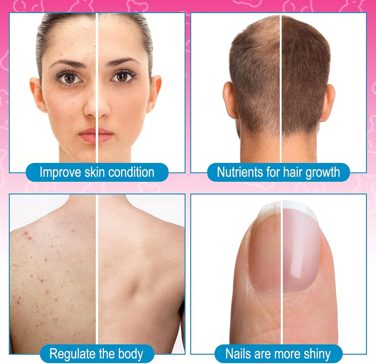 Chewable Biotin Gummies for Skin, Hair & Nails-Hair