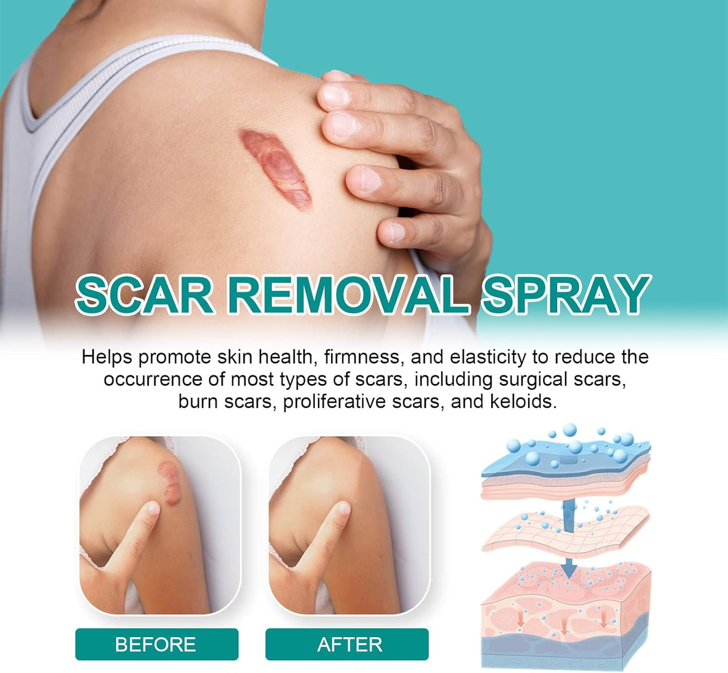 Medical Grade Scar Spray, Scar Remove Medical Grade Scar Spray, Scar Remove Advanced Scar for All Types of Scars (20g)