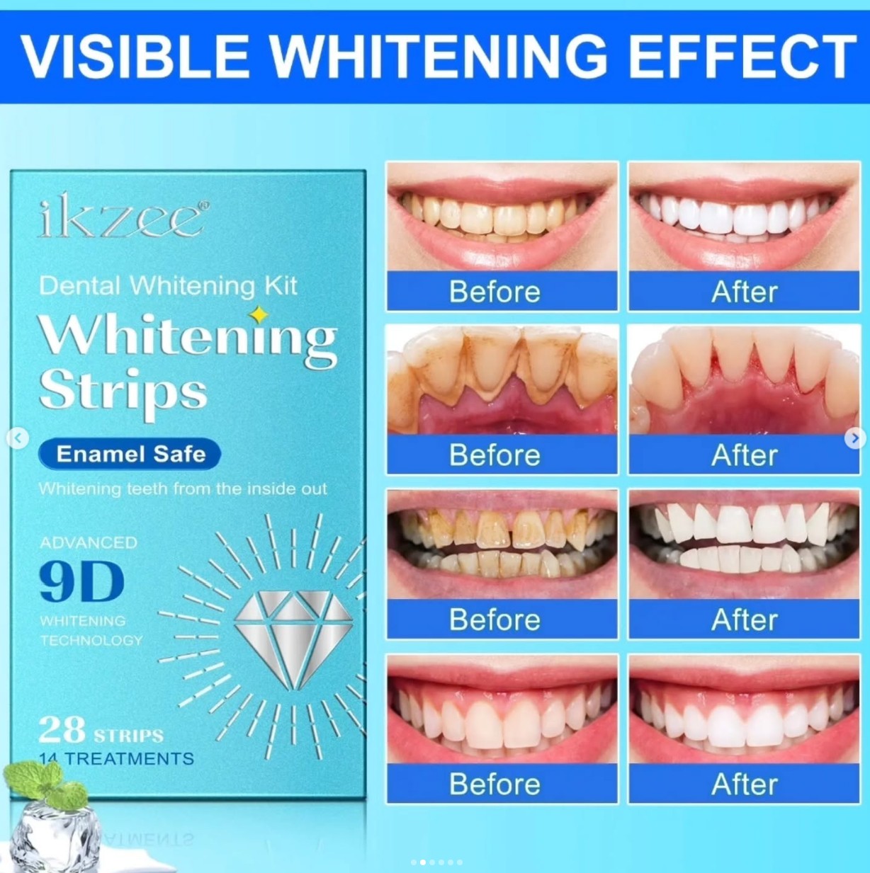 9D Teeth Whitening Strips