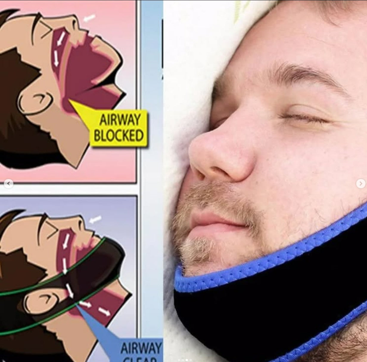 Anti Snoring Chin Strap Sleep Apnea Support