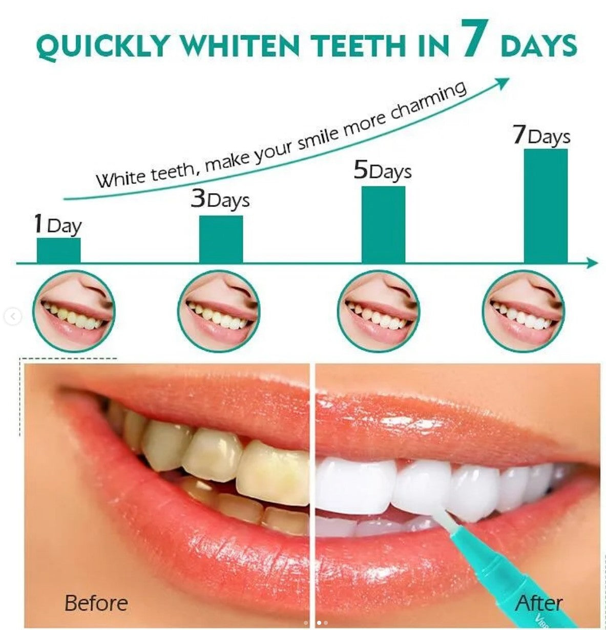 Vibrant Glamour teeth whitening pen