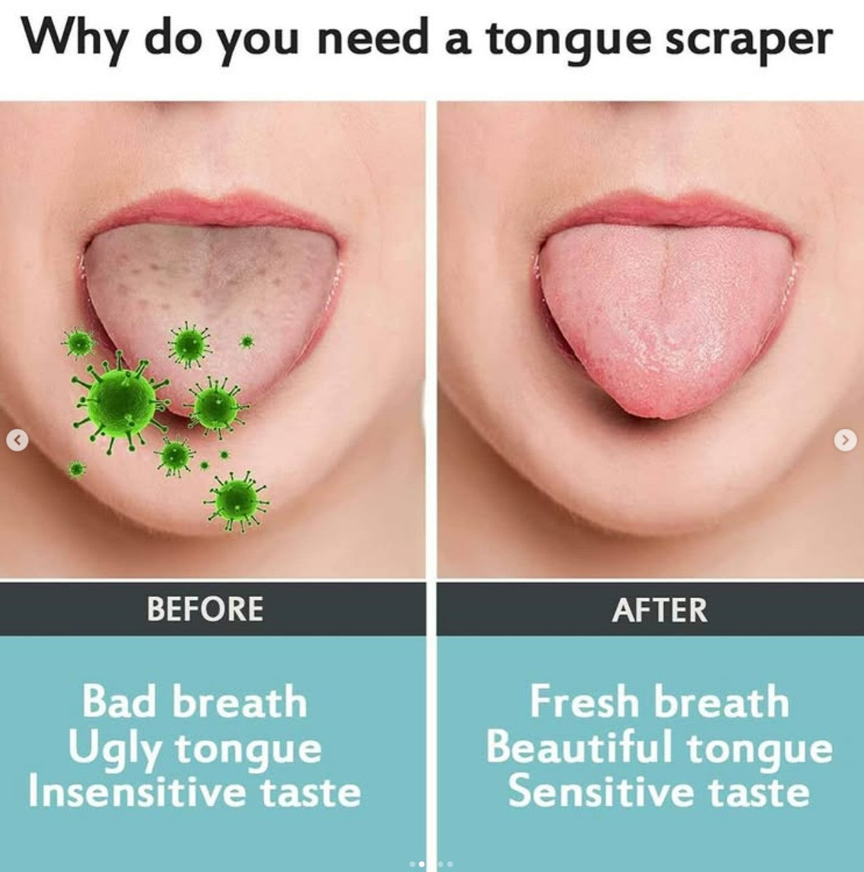 Tongue Scraper (2 Pack)