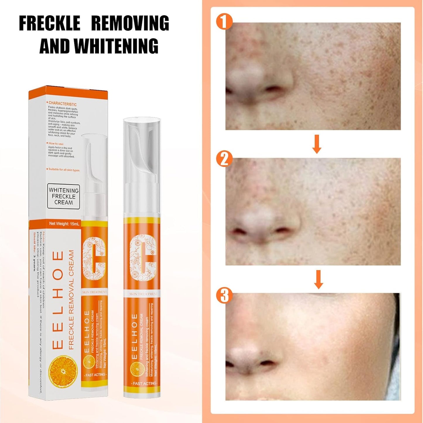 VC Whitening Freckle Cream Pen, Effective Remove Melasma Acne Spots (1PC)