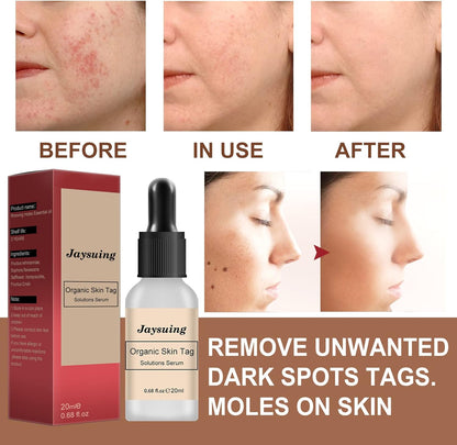 Black Spot Removal Lotion