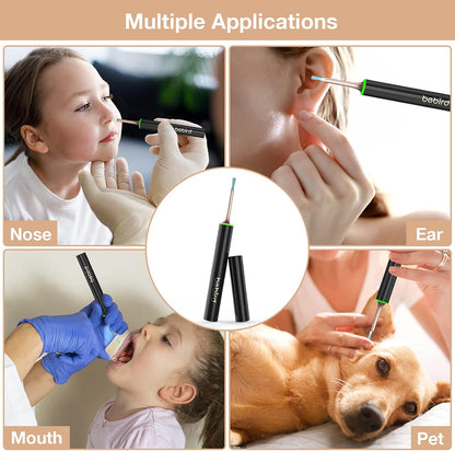 Bebird Earwax Remover with Pimple Popper Tool & Magenetic Cap